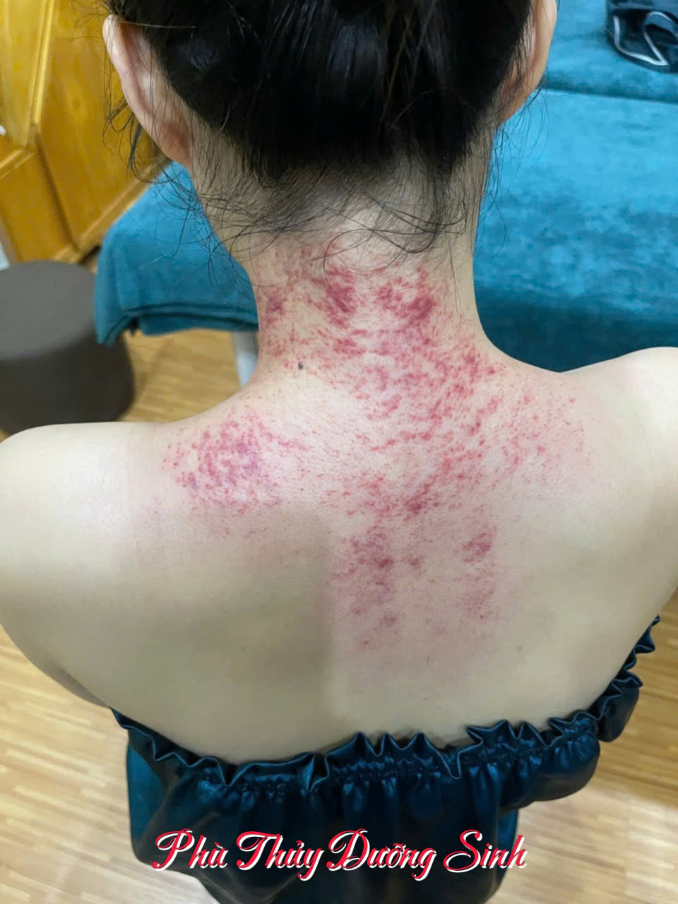 “Đau mấy cũng xử lý được – đặt lịch trải nghiệm ngay!”😳 Có những cơn đau…Bạn đã quen với việc chịu đựng– Vai gáy đau âm ỉ– Lưng mỏi kéo dài– Tê tay, nặng chân– Đầu lúc nào cũng căng và mệtBạn nghĩ phải sống chung với nó…Nhưng thực ra, cơ thể đang chờ được xử lý đúng cách😌 Tại Hà Đan Dưỡng:– Không làm qua loa, mà đi thẳng vào điểm đau– Xác định đúng nguyên nhân theo từng cơ thể– Tác động chính xác, không lan man🌿 Với phương pháp dưỡng sinh Đông y:✔ Khai thông kinh lạc – giải phóng điểm tắc✔ Tác động đúng huyệt giúp giảm đau rõ rệt✔ Kết hợp thảo dược giúp cơ thể giãn và phục hồi sâu✔ Điều chỉnh cơ thể về trạng thái cân bằng😌 Ngay trong quá trình…Bạn sẽ cảm nhận rõĐiểm đau được “mở ra”, cơ thể nhẹ dầnSau khi kết thúc…– Đau giảm rõ– Cơ thể dễ chịu hơn– Tinh thần nhẹ và thoáng💛 Không phải chịu đựng thêm nữaCơ thể bạn hoàn toàn có thể thay đổi