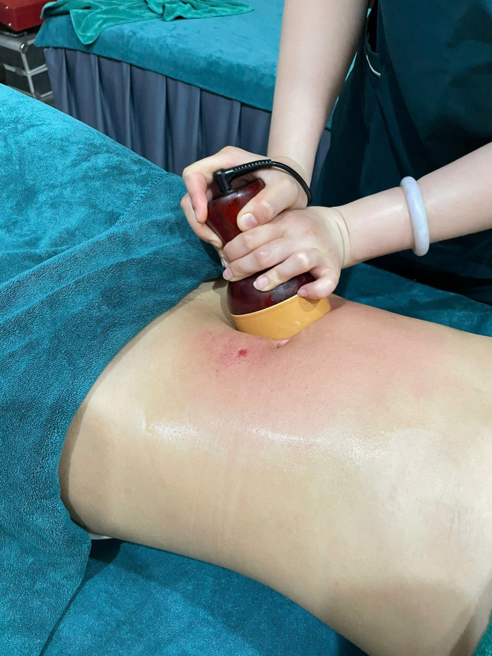 “Tỳ vị được đánh thức – người nhẹ, bụng ấm, năng lượng trở lại”😳 Chỉ khi cơ thể nhẹ hẳn đi…Bạn mới nhận ra trước đó mình đã mệt mỏi đến mức nào– Bụng từng nặng, giờ trở nên êm và ấm– Người từng uể oải, giờ nhẹ và có lực hơn– Cảm giác đầy tức biến mất, thay bằng sự dễ chịu rõ rệtKhông phải thay đổi đột ngộtMà là cơ thể đang dần hồi phục từ bên trong🌿 Khi tỳ vị được “đánh thức” đúng cáchChức năng tiêu hoá bắt đầu hoạt động trơn truKhí huyết lưu thông tốt hơnCơ thể hấp thu và chuyển hoá hiệu quả hơn✨ Tại Hà Đan Dưỡng, liệu trình tập trung:✔ Tác động vùng bụng – lưng giúp kích hoạt tỳ vị✔ Khai thông kinh lạc, giải phóng tích trệ✔ Kết hợp thảo dược giúp làm ấm và nuôi dưỡng từ bên trong😌 Trong quá trình…Bạn sẽ cảm nhận rõBụng ấm dần lên, cơ thể nhẹ điMột nguồn năng lượng quay trở lại rất tự nhiênKhi kết thúc…– Bụng nhẹ, dễ tiêu– Người thoải mái, không còn uể oải– Một trạng thái cân bằng rất rõ rệt💛 Đôi khi, bạn không cần cố gắng nhiều hơnChỉ cần cơ thể được phục hồi đúng cách📩 Inbox ngay để trải nghiệmVà giữ lịch sớm trước khi kín chỗ hôm nay!________________________________________#duongsinhdongy #tyvi #bungam #nangluong #HaDanDuong